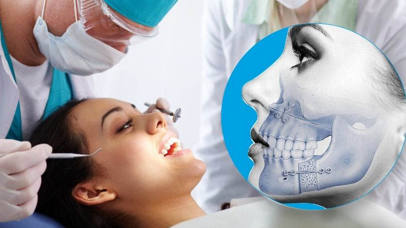 Maxillofacial Surgery