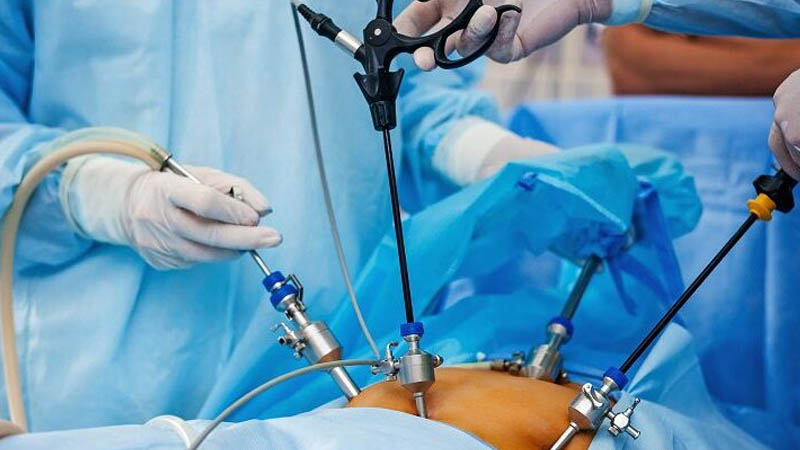 General / laproscopic Surgery